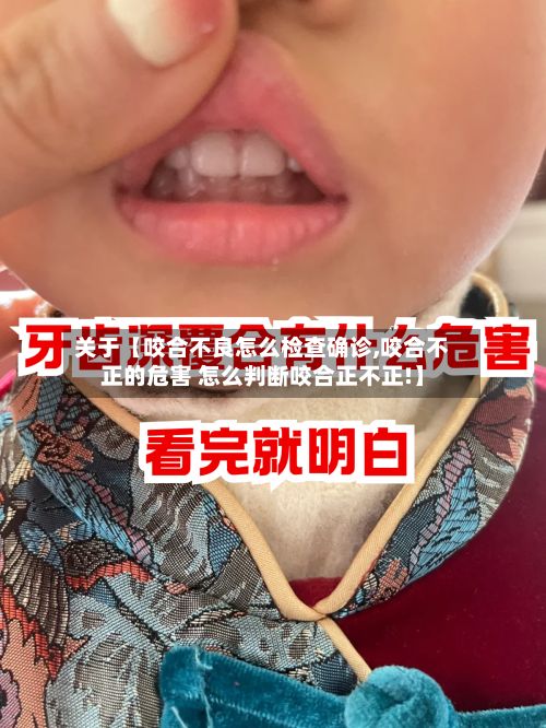 关于【咬合不良怎么检查确诊,咬合不正的危害 怎么判断咬合正不正!】-第1张图片