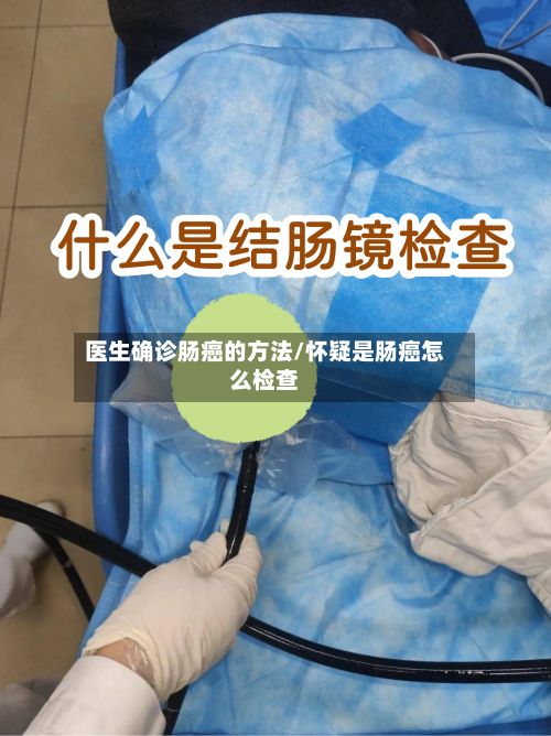 医生确诊肠癌的方法/怀疑是肠癌怎么检查-第2张图片