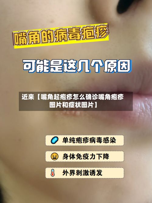 近来【嘴角起疱疹怎么确诊嘴角疱疹图片和症状图片】