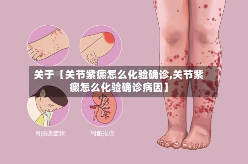 关于【关节紫癜怎么化验确诊,关节紫癜怎么化验确诊病因】-第1张图片