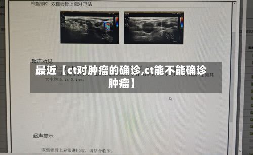 最近【ct对肿瘤的确诊,ct能不能确诊肿瘤】