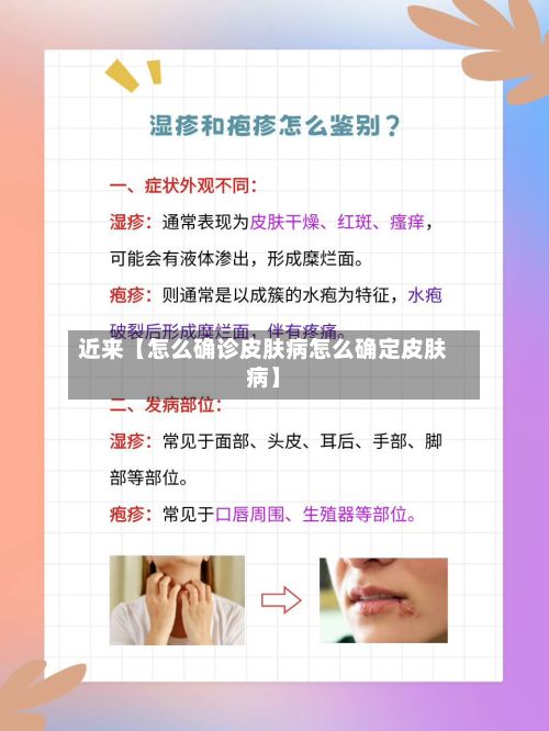 近来【怎么确诊皮肤病怎么确定皮肤病】-第3张图片