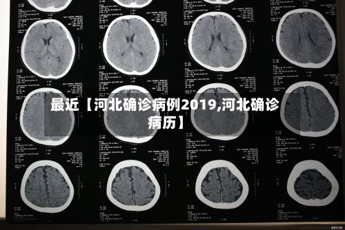 最近【河北确诊病例2019,河北确诊病历】-第2张图片