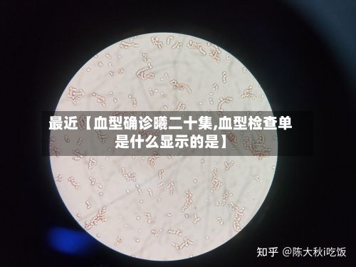 最近【血型确诊曦二十集,血型检查单是什么显示的是】-第3张图片