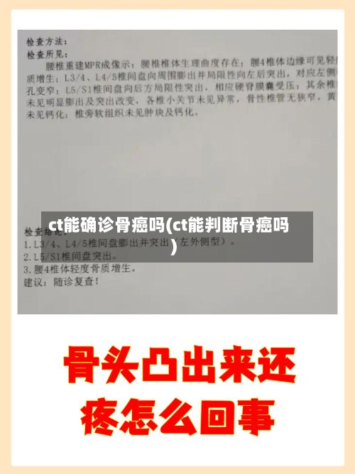 ct能确诊骨癌吗(ct能判断骨癌吗)-第2张图片