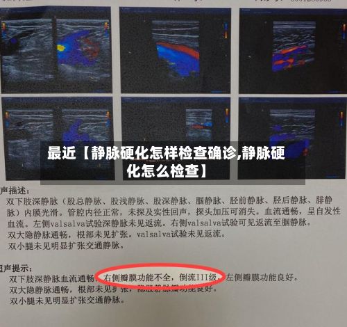 最近【静脉硬化怎样检查确诊,静脉硬化怎么检查】-第2张图片