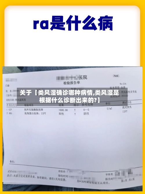 关于【类风湿确诊哪种病情,类风湿是根据什么诊断出来的?】-第2张图片