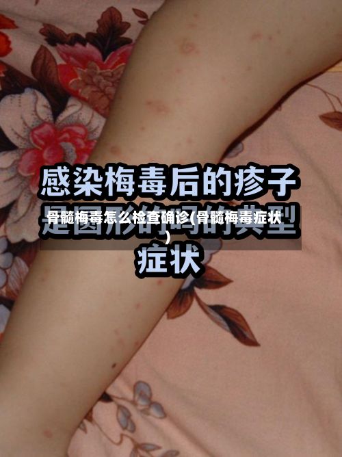 骨髓梅毒怎么检查确诊(骨髓梅毒症状)