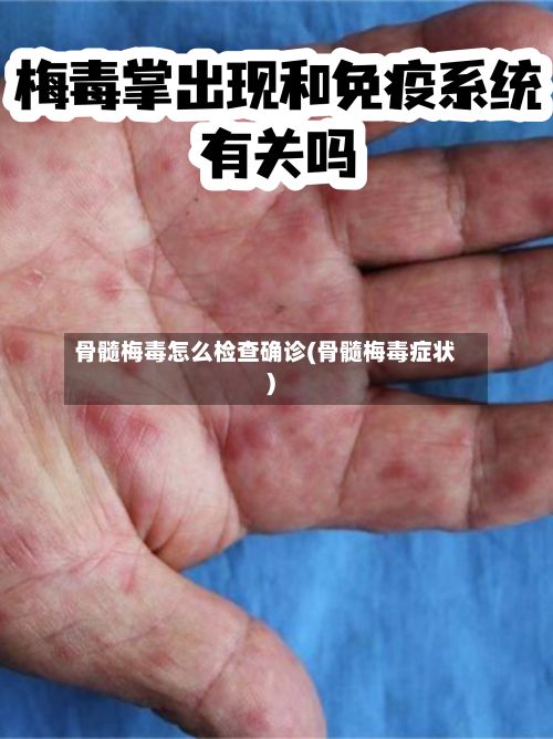 骨髓梅毒怎么检查确诊(骨髓梅毒症状)-第2张图片