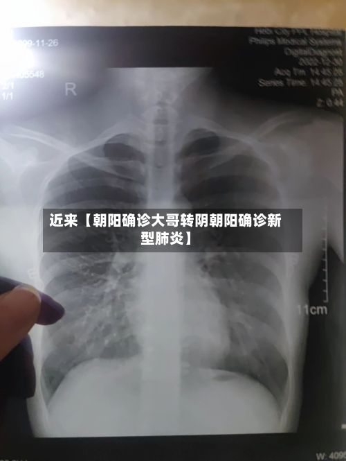 近来【朝阳确诊大哥转阴朝阳确诊新型肺炎】